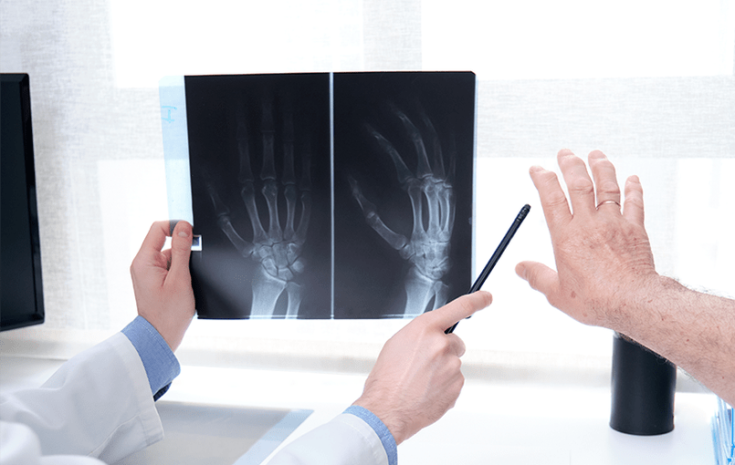 sąnarių artrozės diagnozė